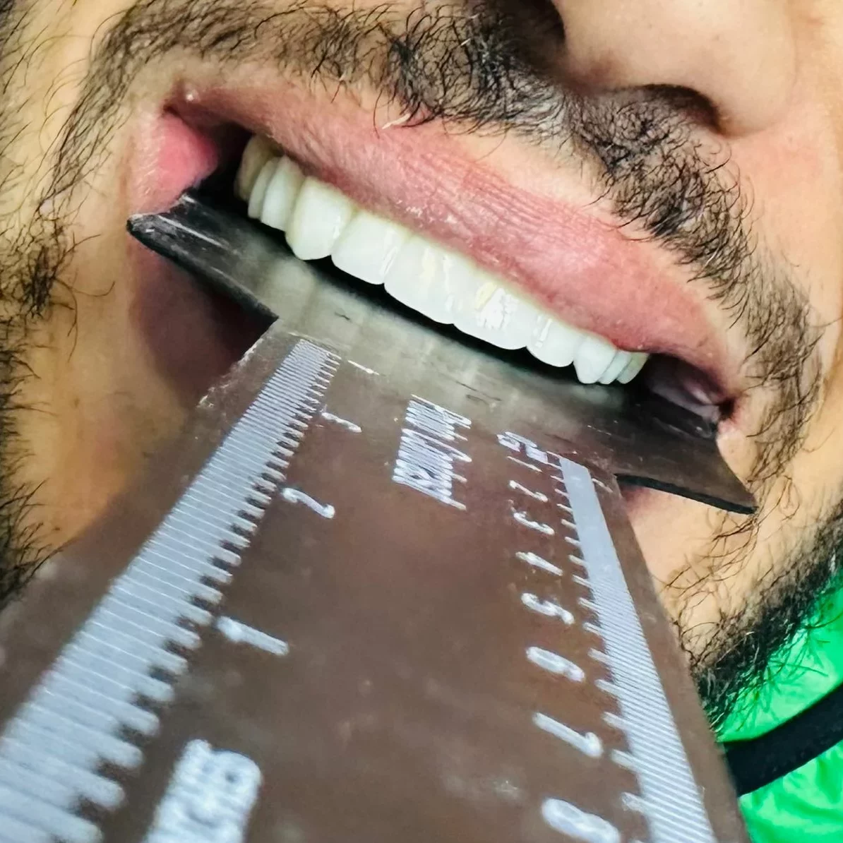Nemess Dental patient after
