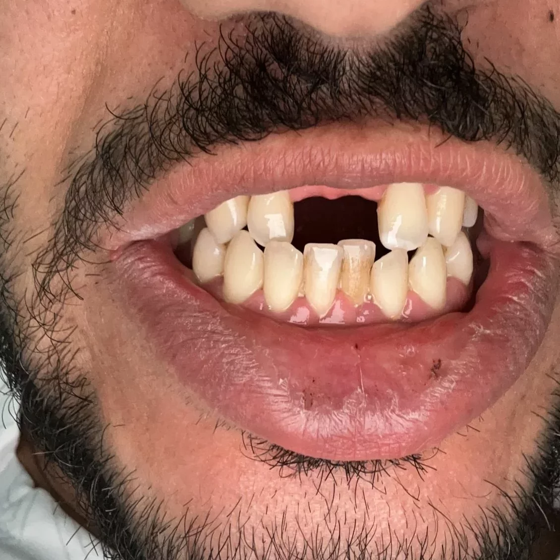 Nemess Dental patient before