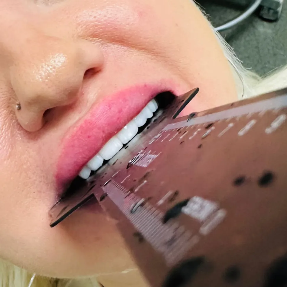 Nemess Dental client after picture