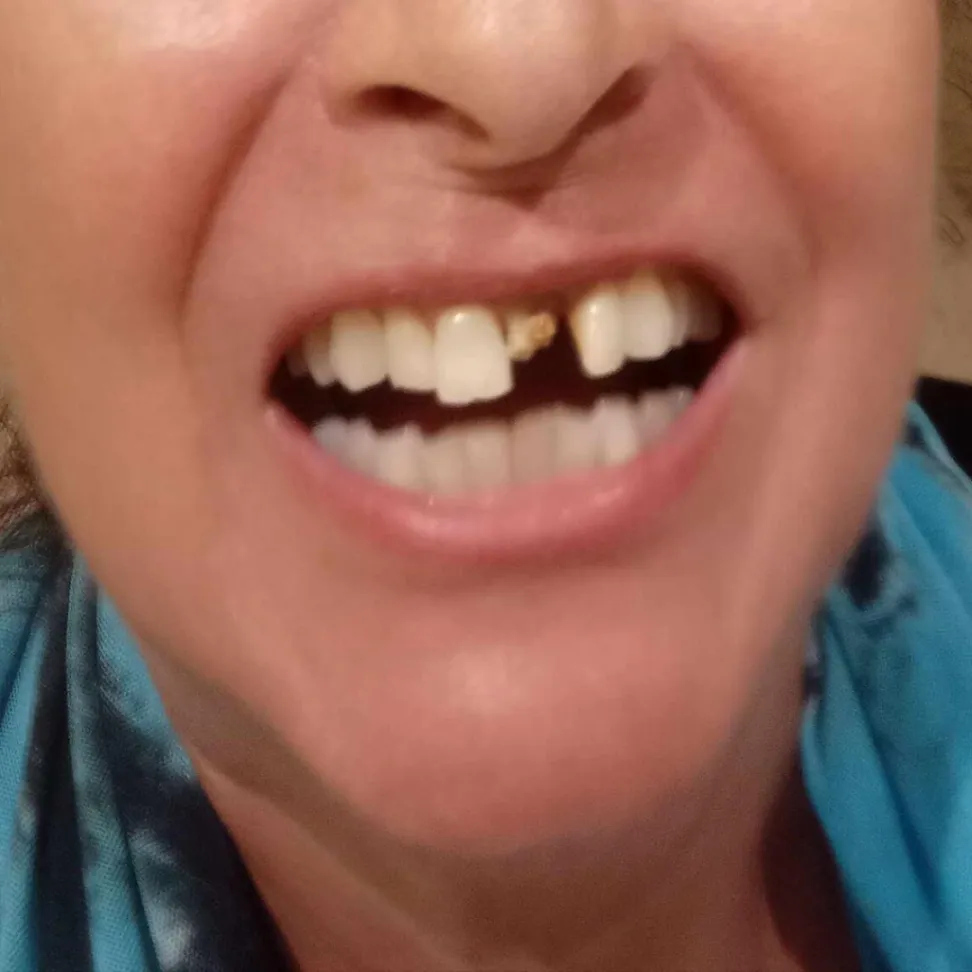 Nemess Dental client reference before picture