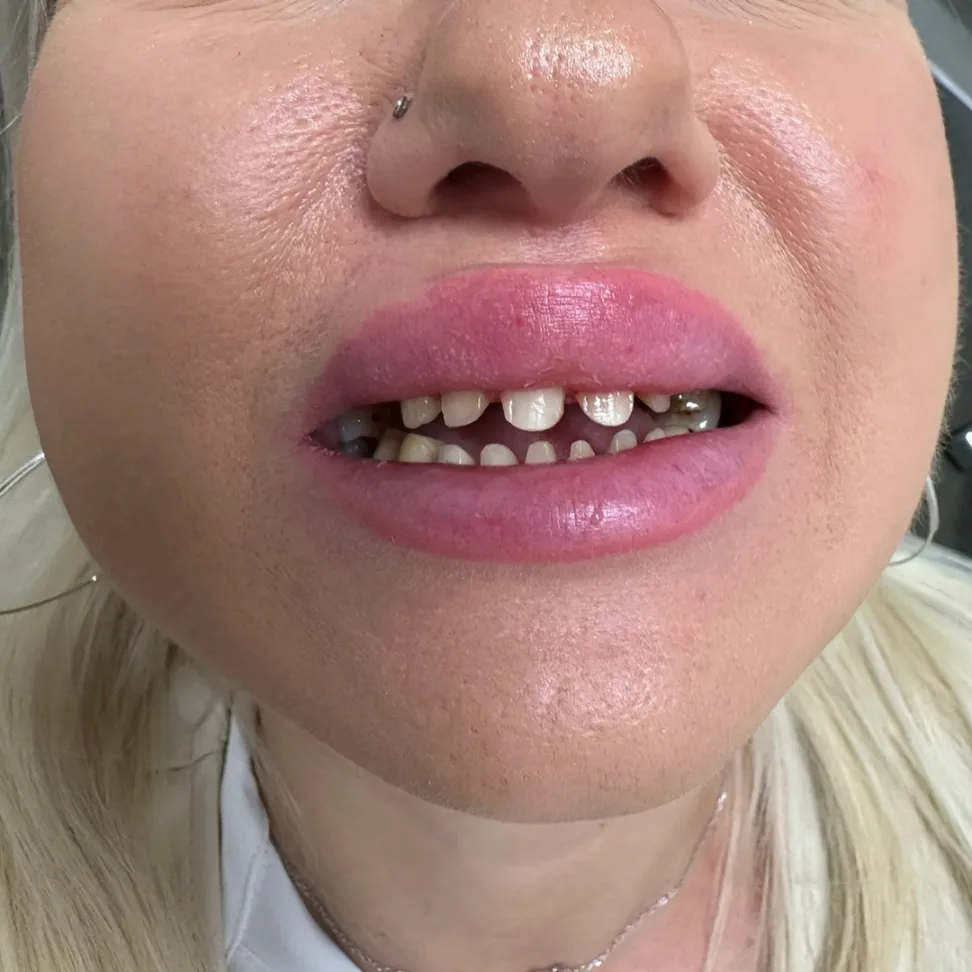 Nemess Dental client before picture